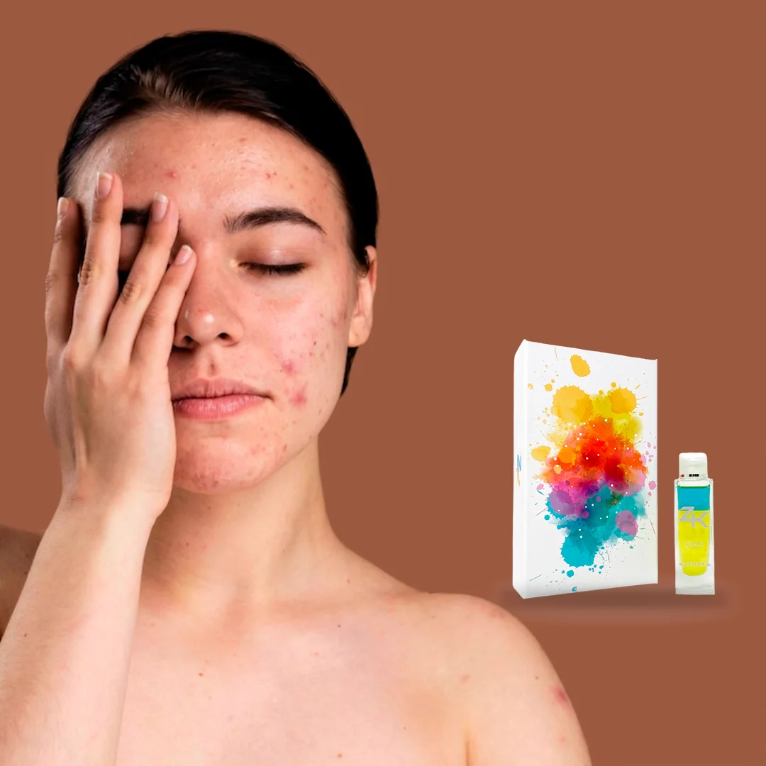 Tratamientos Antiacne y Antimanchas
